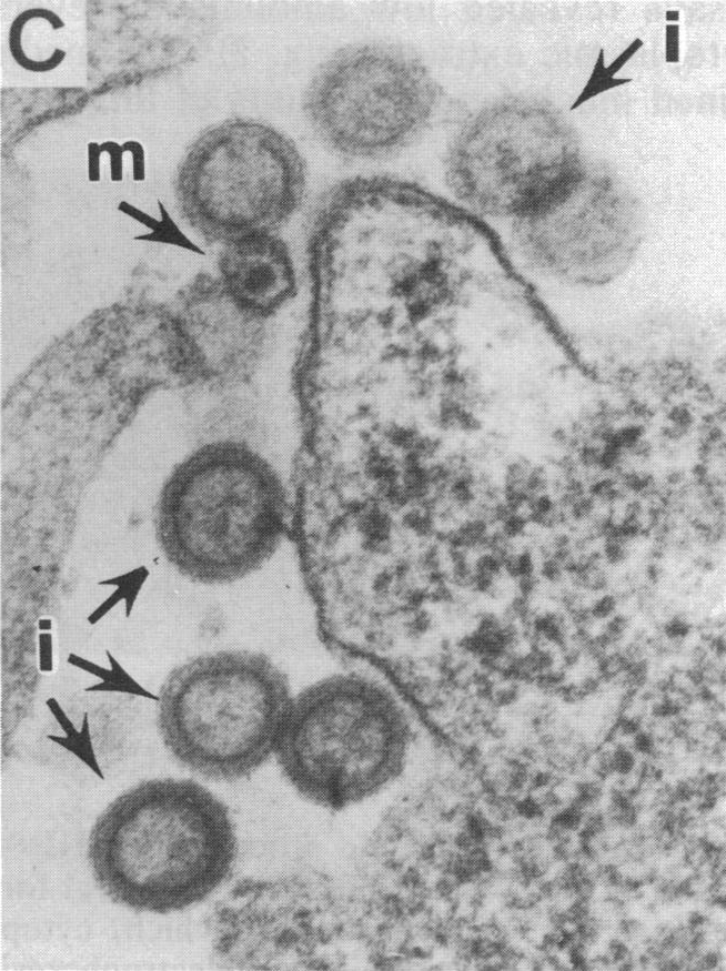 a virus that attacks the body's immune system