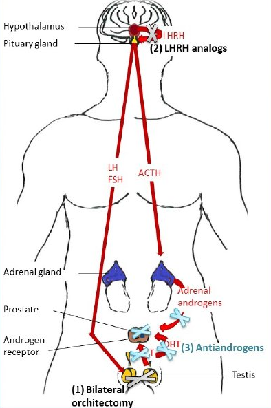 Administered with androgen deprivation therapy