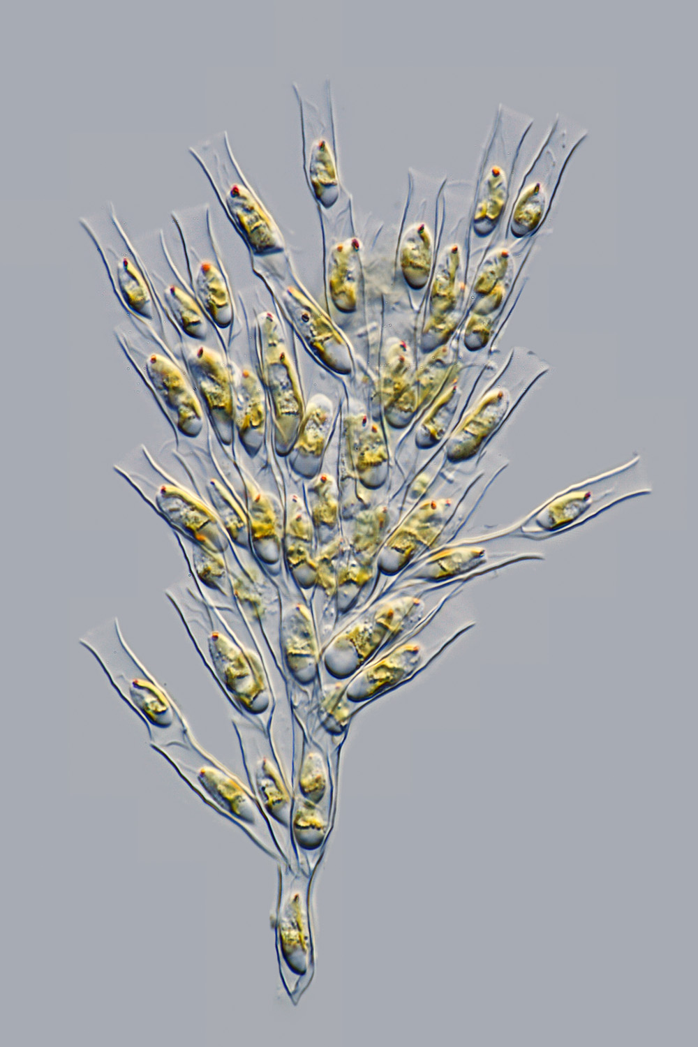 Golden Algae