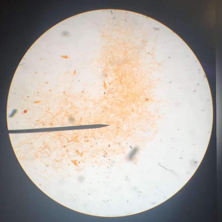 Rhizopus Mycelium 100x