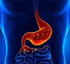 Having an acidic stomach due to spicy food can be relieved by taking an antacid (alkaline/ basic).