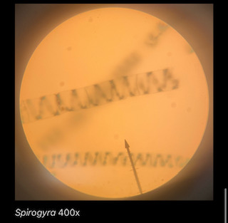 Spirogyra 400x