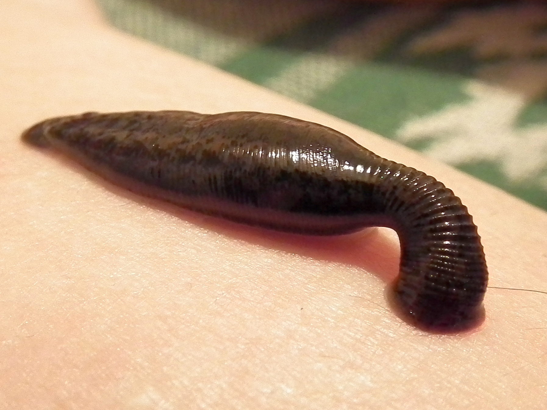 Hirudinea