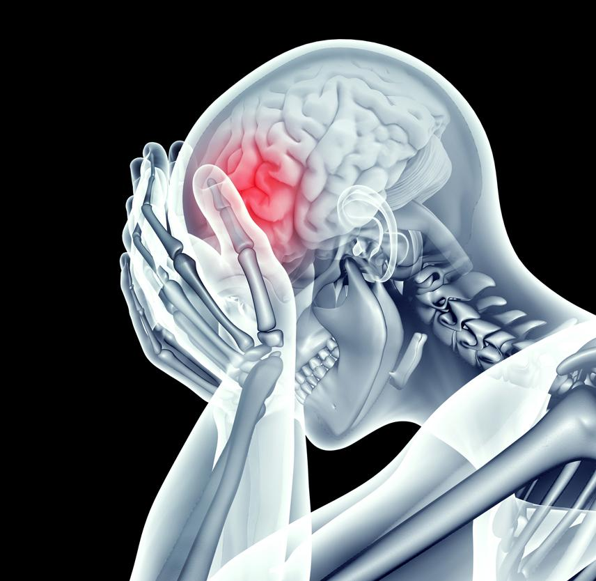Brain Injury