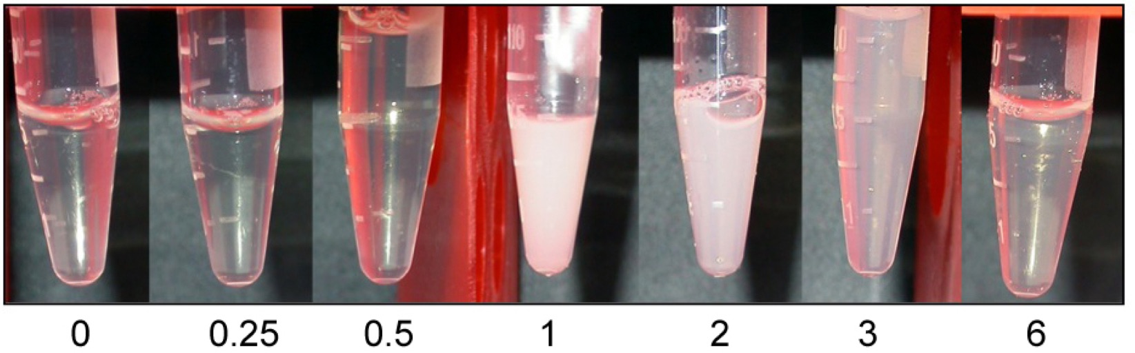 Serum Lipid Levels