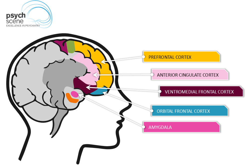 those w/ depression show increased levels of activity
in the amygdala and less activity in prefrontal lobe