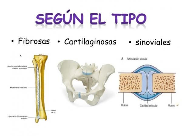 Por  su estructura
