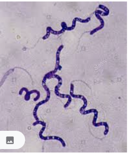 Ex. Sprillum shaped eubacteria