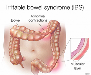 IBS labelled diagram