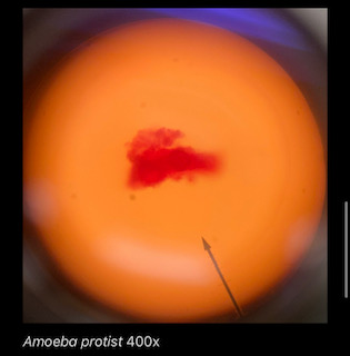 Amoeba proteus 400x