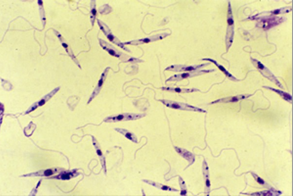 Ex. Leishmania