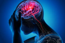 Stroke