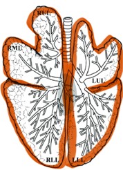 Bronconeumonía y neumonía intersticial