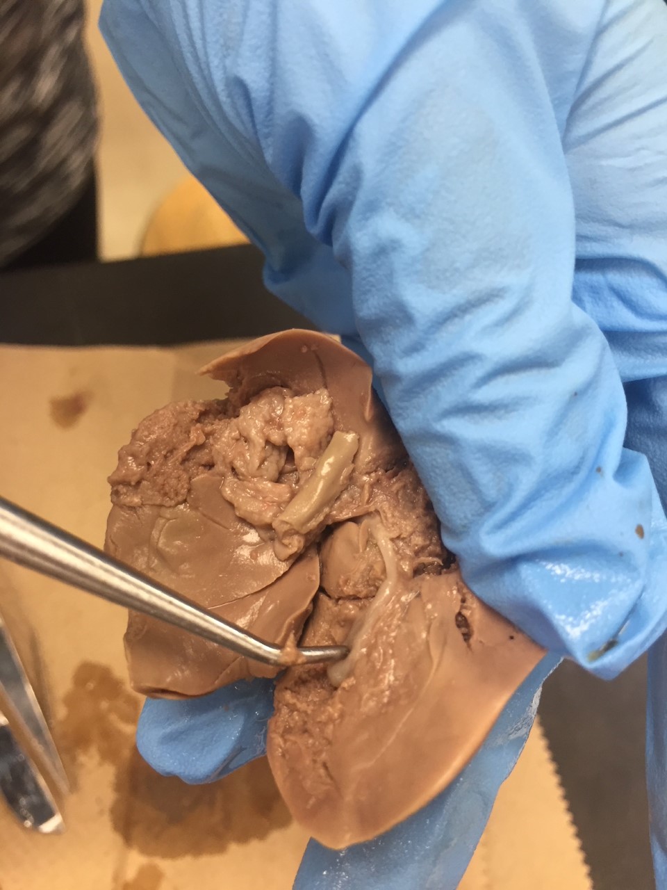 The probe is pointing to the pig's gallbladder.