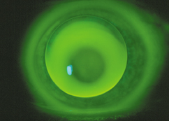 Apical Touch