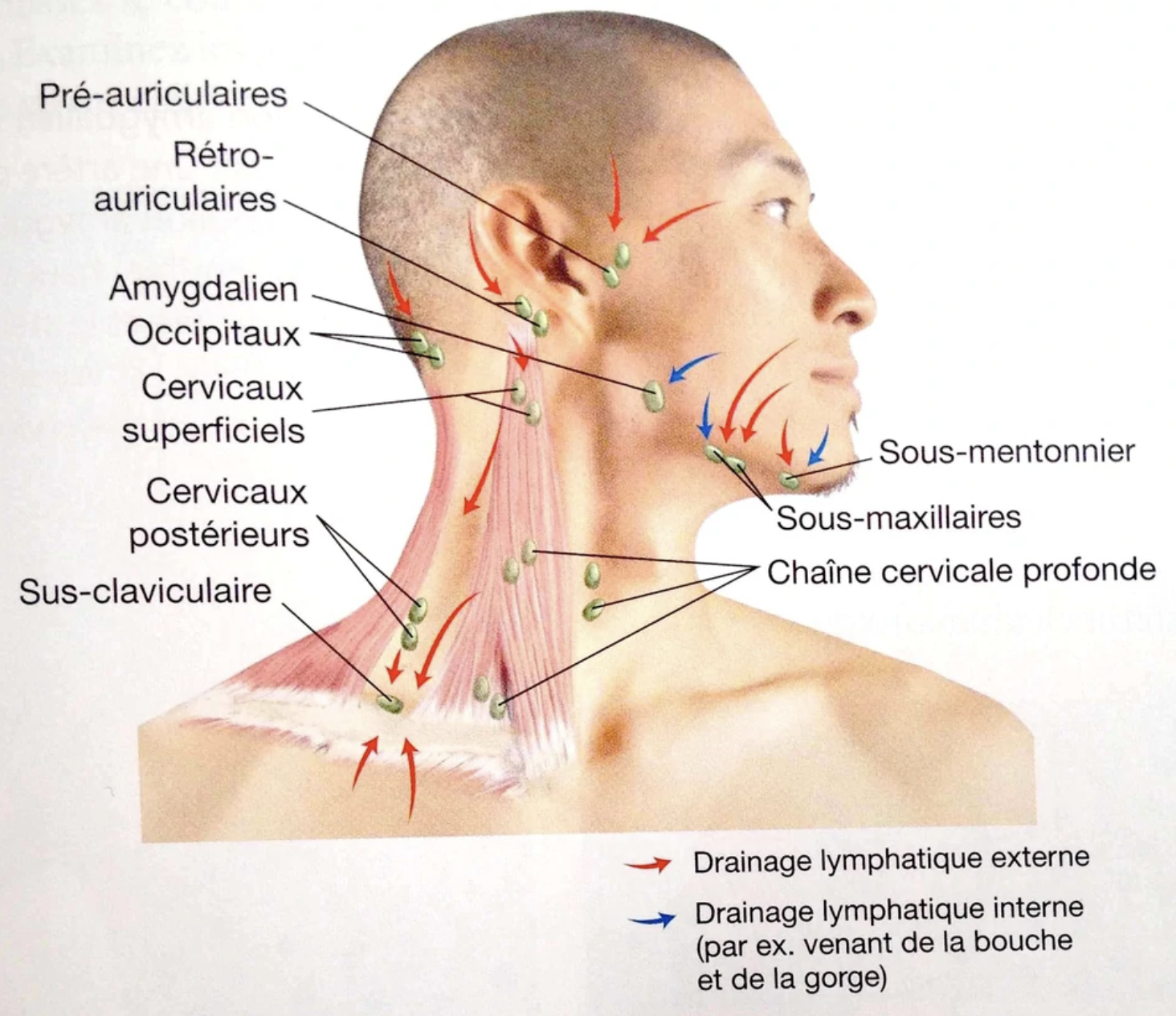 Les adénopathies cervicales
Etiologies:
Infectieuses: (Banales)
- Satellites d’une infection dentaire ou
buccopharyngée
- Inf