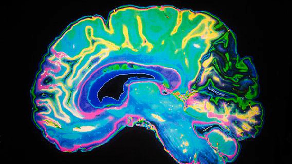 LA DOPAMINA (DA): Es uno de los muchos neurotransmisores que utilizan las neuronas para comunicarse entre ellas. el neurotran