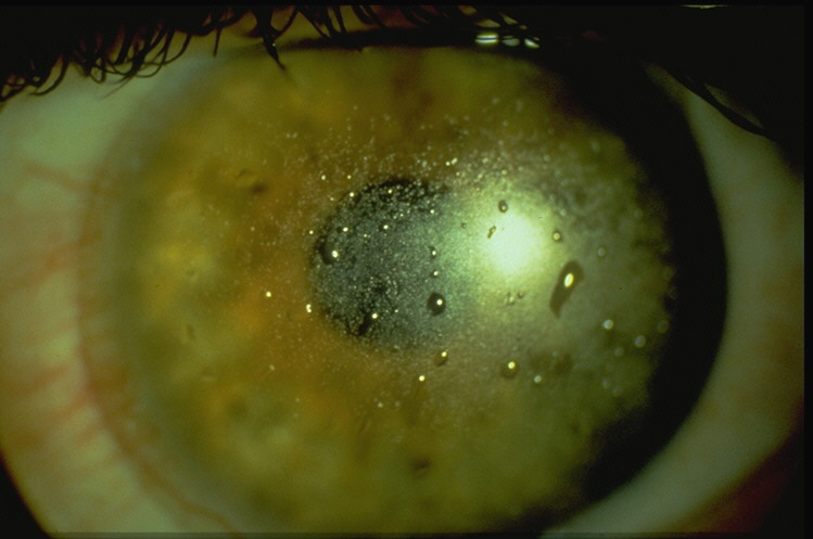 Heavily coated lens