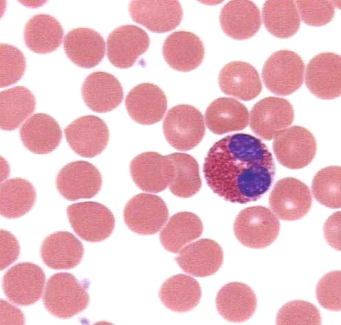 Eosinophils