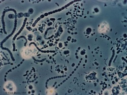 Extreme Halophiles