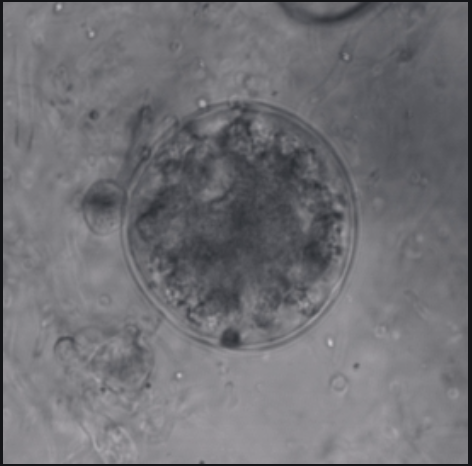 Ex. Chytridiomycota water mould