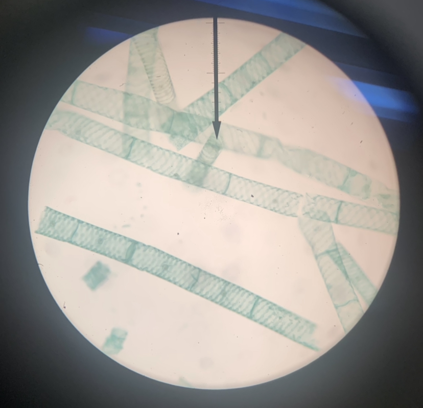 Spirogyra 100x
