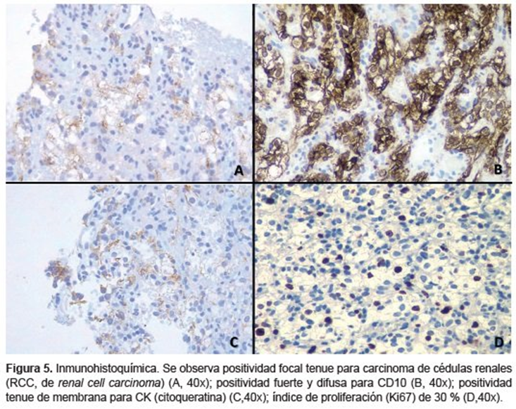 Inmunohistoquímica