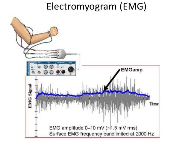 EMG : Electromyogram