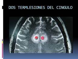 El Cíngulo