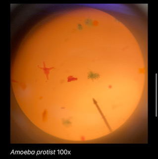 Amoeba proteus 100x