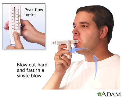 Peak flow meter being demonstrated
