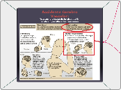 Accidente Cerebro Vascular:            ...- Mapa Mental