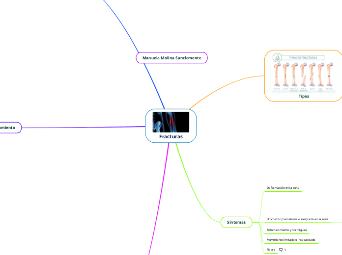 Fracturas - Mapa Mental