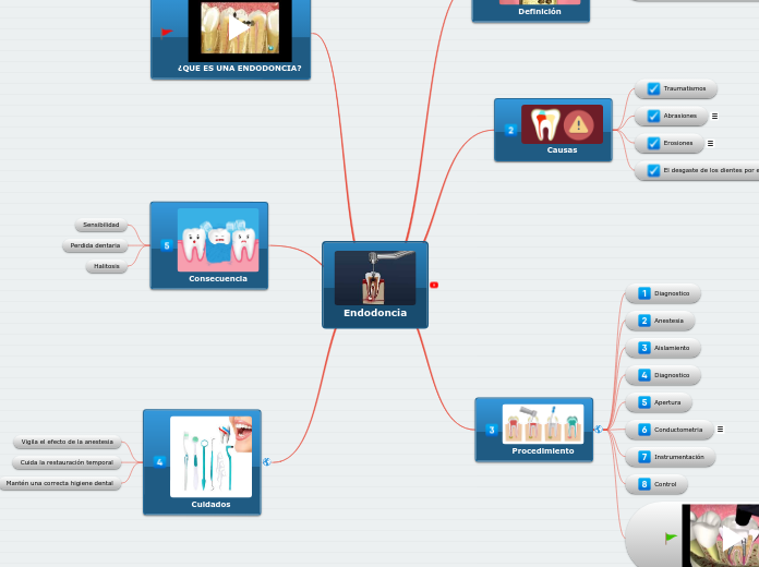 Endodoncia - Mapa Mental