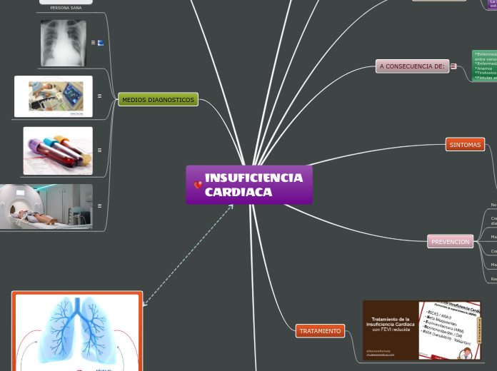 INSUFICIENCIA CARDIACA - Mapa Mental