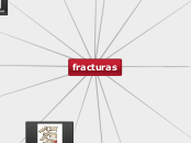 fracturas - Mapa Mental