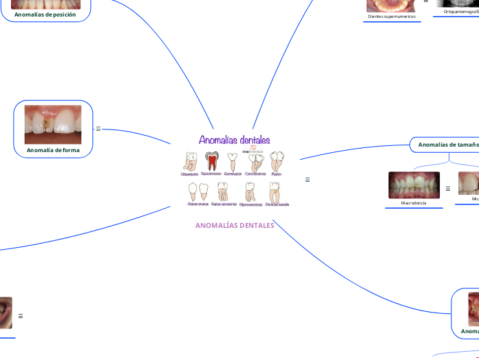 ANOMALÍAS DENTALES - Mapa Mental
