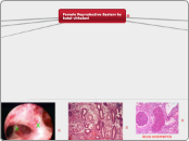 Female Reproductive System by hetal vithal...- Mind Map