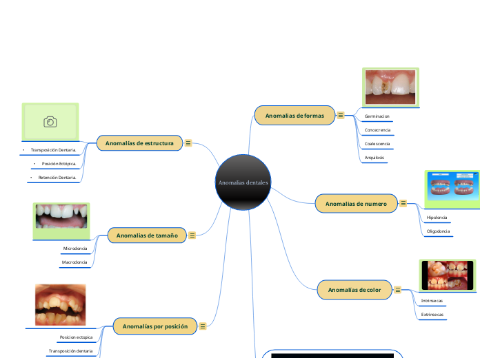 Anomalias dentales - Mapa Mental