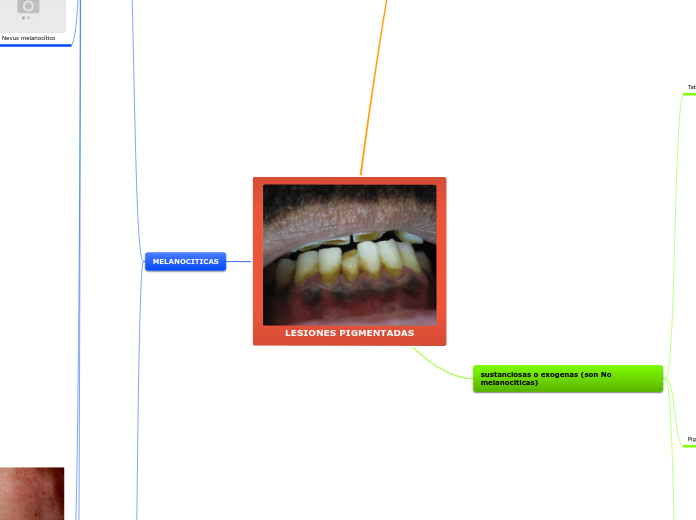 LESIONES PIGMENTADAS - Mapa Mental