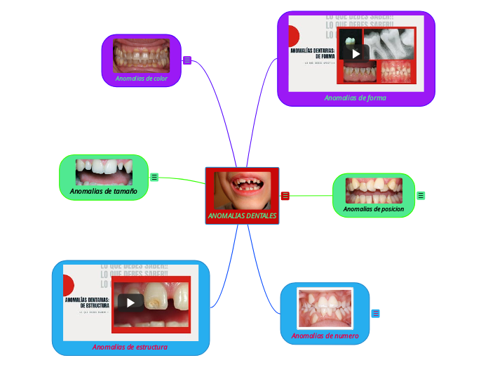 ANOMALIAS DENTALES - Mapa Mental
